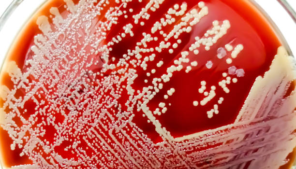 staph aureus: gram-positiv, zu gram-variable, nicht bewegliche, coccus, beta-hämolyse, saprotrophes bakterium, das zur familie staphylococcus oder streptokokken gehört wachstum auf blutagar. - blood agar stock-fotos und bilder