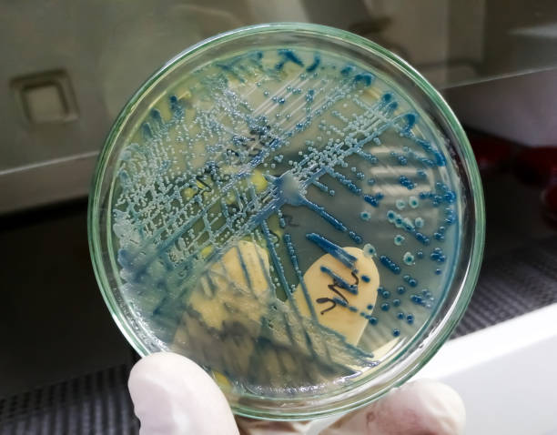 bacteria culture growth on a petri dish in microbiology lab. - bacterial colonies imagens e fotografias de stock