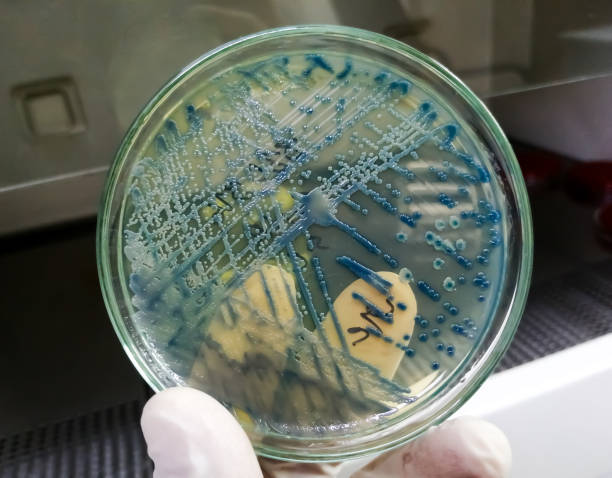 рост культуры бактерий на чашке петри в микробиологической лаборатории. - bacterial colonies стоковые фото и изображения