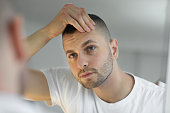 istock Man checking face in mirror 1384645620