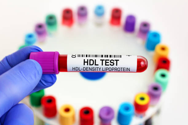 doctor with Blood tube for HDL High Density Lipoprotein test for analysis levels of cholesterol stock photo