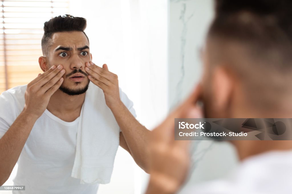 Dull Skin Concept. Worried Arab Guy Looking At Mirror And Touching Face Dull Skin Concept. Worried Arab Guy Looking At Mirror And Touching Face, Shocked Young Middle Eastern Man Examining Dark Circles Under Eyes While Standing In Bathroom At Home, Selective Focus Men Stock Photo
