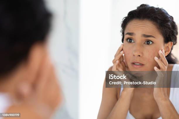 Atopic Skin Concept Worried Young Woman Looking At Mirror And Touching Face Stock Photo - Download Image Now