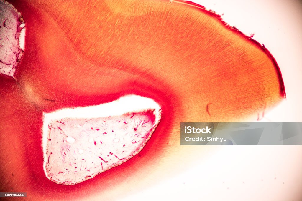 Teeth N Microscope Tooth Development From Human Under Microscope View For Education Stock ...
