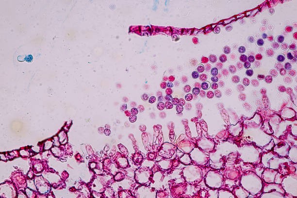 istock Host cells with spores (mold) are inside wood under the microscope for education. 1384987000