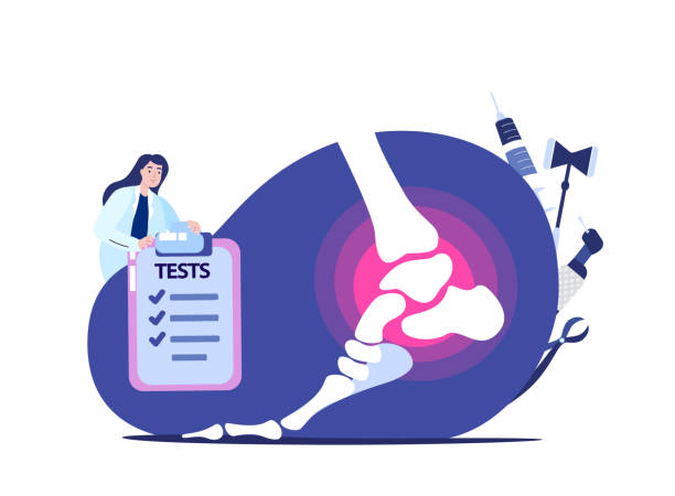 발목, 발 관절염. 여자 작은 닥터 외상학자 정형 외과 분석 시험을 사용하여 인간의 발 관절을 검사, 엑스레이 사진, 플랫 벡터 일러스트. 골관절염, 류마티스 관절염, 관절 질환. - orthopedic equipment osteoporosis x ray human spine stock illustrations