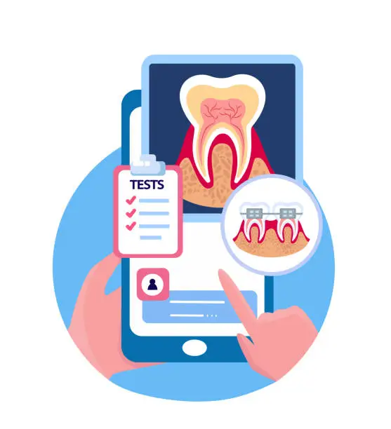 Vector illustration of Online Touchscreen Stomatology Mobile Application.Smartphone Tooth dental X Ray Ridiography,Rontgen Tests.Clinic Consultation,Medical.Internet Diagnostics.Digital Braces Treatment.Vector Illustration