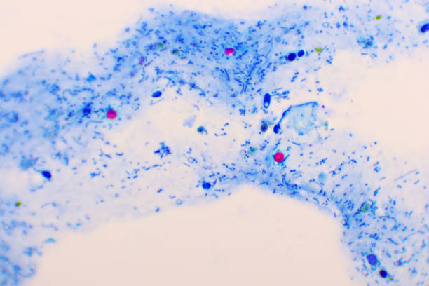 Cryptosporidium parvum protozoa in human stool stock photo