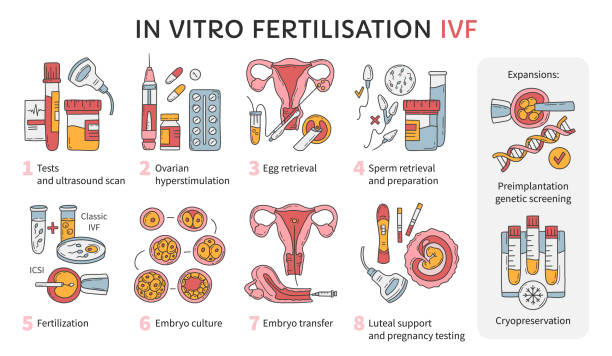 illustrations, cliparts, dessins animés et icônes de fécondation in vitro vecteur fiv infographie et schéma de traitement de l’infertilité - cryobiology