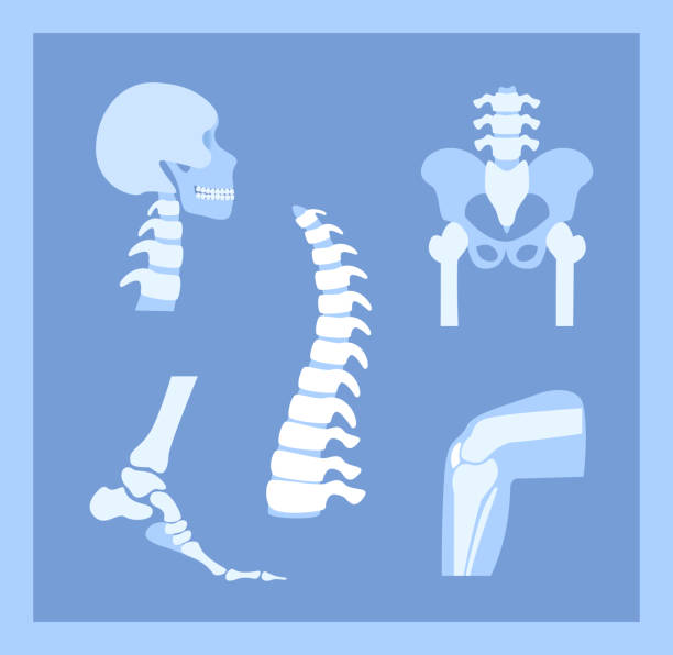 류마치스성 관절염, 통증, 뼈 질환 개념. 목 자궁 경부 척추, 척추, 무릎, 발목 및 기타 관절 아이콘으로 설정합니다. 인체의 일부, 해부학 의료 포스터. xray 플랫 벡터 일러스트레이션 - rheumatic stock illustrations