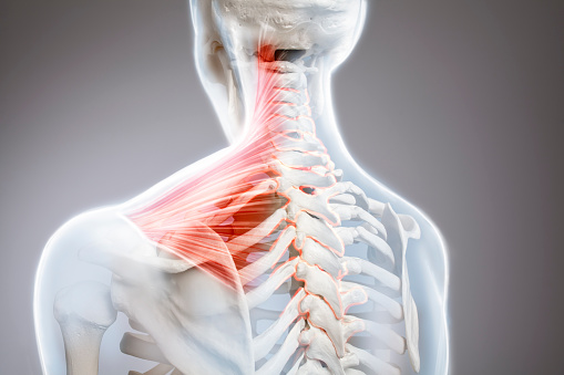 Dolor de cuello, columna vertebral de las vértebras cervicales, anatomía del cuerpo humano photo