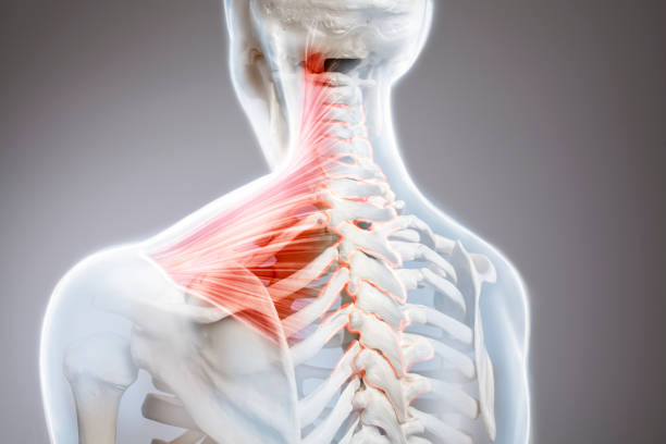 dolor de cuello, columna vertebral de las vértebras cervicales, anatomía del cuerpo humano - neck pain fotografías e imágenes de stock