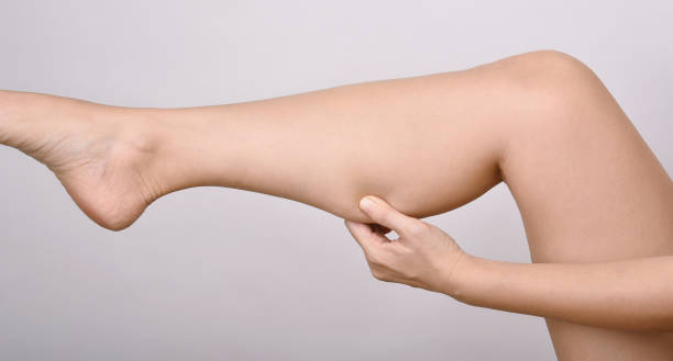 Calf fat, Fat woman pinching thigh leg skin, Overweight body test. stock photo