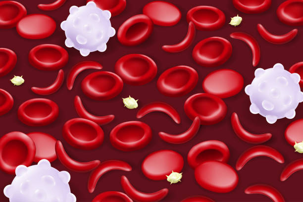 blut der sichelzellenanämie. sichelförmige rote blutkörperchen. - sickle cell anemia red blood cell blood cell anemia stock-grafiken, -clipart, -cartoons und -symbole