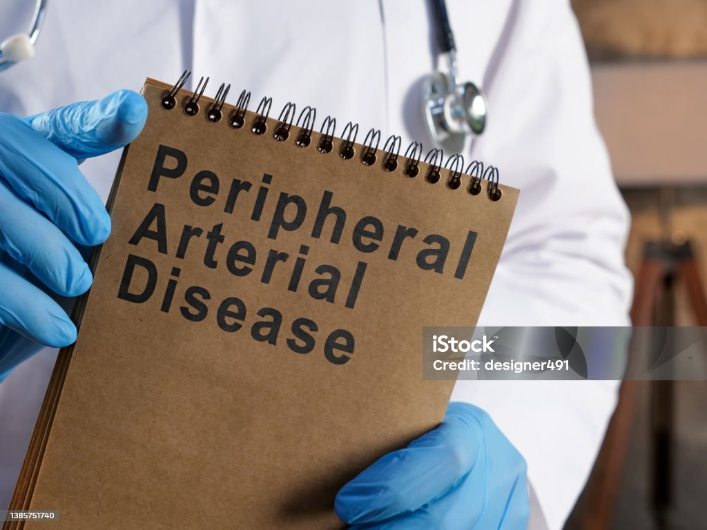 Doctor shows page with Peripheral arterial disease PAD. A Doctor shows page with Peripheral arterial disease PAD. Illness Stock Photo
