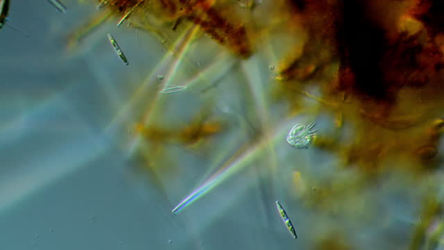 Ciliates - microscopic organisms