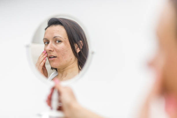 鏡を見て肌の問題を抱えている女性の写真。 - human skin dry human face peeling ストックフォトと画像