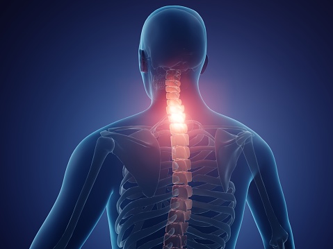 3d illustration showing neck pain