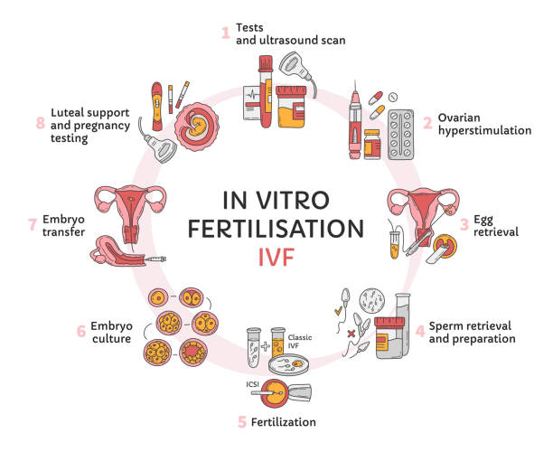 In Vitro fertilization IVF vector circle infographic and infertility treatment In Vitro fertilization IVF vector circle infographic, infertility treatment scheme. Ovarian hyperstimulation, artificial insemination, embryo culture, luteal support. Medical procedure for pregnancy human fertility stock illustrations