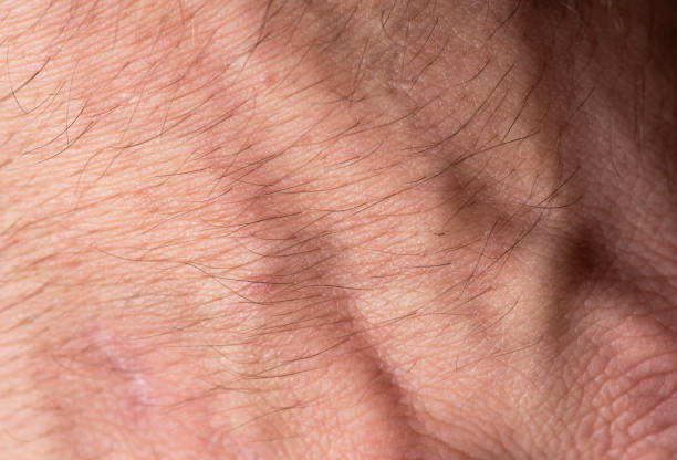 istock Close-up human skin, macro photography. 1386285269