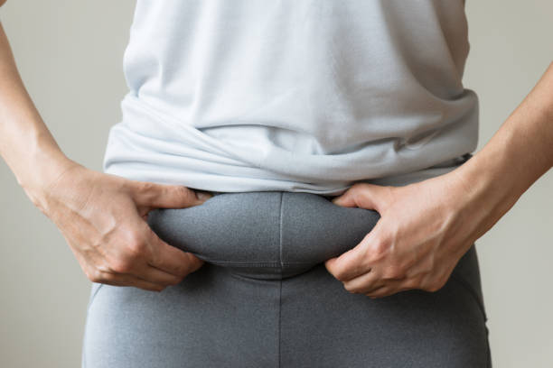 Belly Fat stock photo