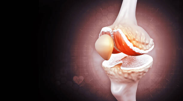 istock Anatomy of human knee joint.3d illustration 1386445720