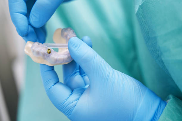 istock Doctor hands holding teeth model with dental implant 1386446068