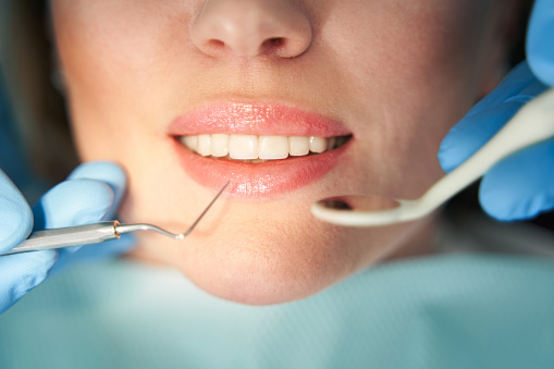 Médico estomatólogo examinando los dientes de la mujer en la clínica dental photo