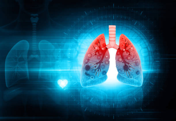 istock virus or bacteria infected lungs on medical background.3d illustration 1386458333