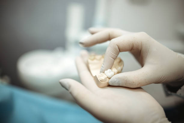 vérification des empreintes dentaires - implant photos et images de collection
