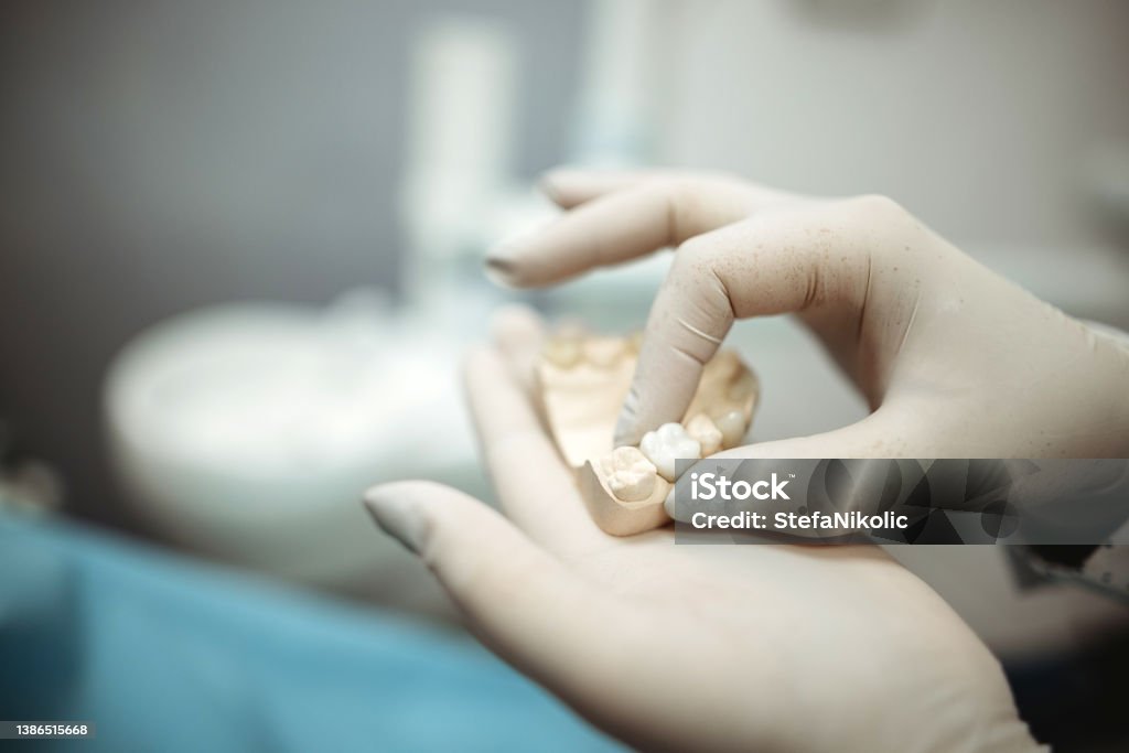 Checking Dental Impression Dentist hand with plaster model Tooth Crown Stock Photo