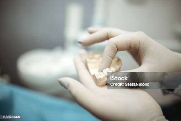 Checking Dental Impression Stock Photo - Download Image Now - Tooth Crown, Dental Implant, Teeth