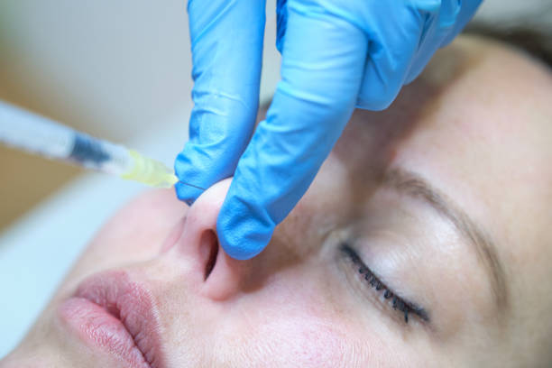 istock elevation of the nasal tip injecting botulinum toxin 1386585451
