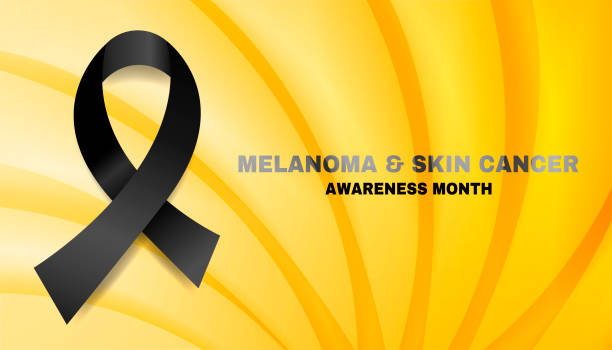 Melanoma and Skin Cancer Awareness Month. Concept with black ribbon awareness. Banner template. Vector illustration. Melanoma and Skin Cancer Awareness Month. Concept with black ribbon awareness. Banner template. Vector illustration. melanoma stock illustrations