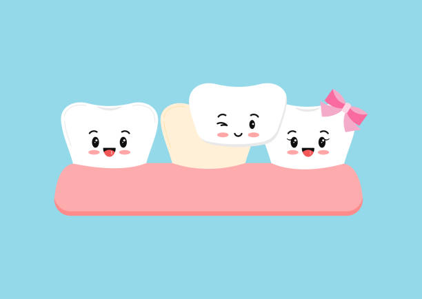 Cute white tooth and tooth with veneer. Cute white tooth and tooth with veneer. Teeth aesthetic treatment, cleaning, color restoration concept. Flat cartoon emoji character vector illustration. Dental hygiene stained teeth teeth clipart stock illustrations