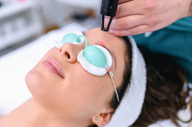 istock Hair removal with laser diod 1386869435
