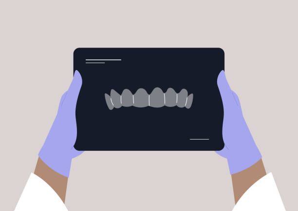 ilustrações, clipart, desenhos animados e ícones de 5 mãos de raios xray de dentes - radiogram photographic image