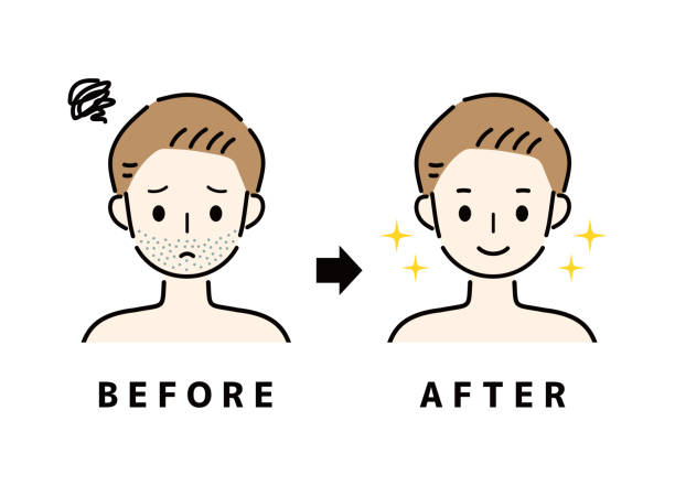 ilustraciones, imágenes clip art, dibujos animados e iconos de stock de un hombre cuya barba ha sido depilada. - barba de tres días