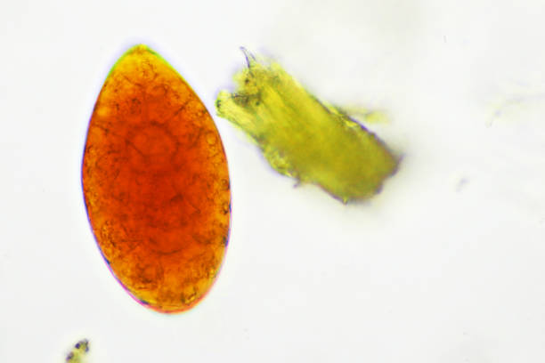 istock Egg of intestinal fluke in human stool 1387095112
