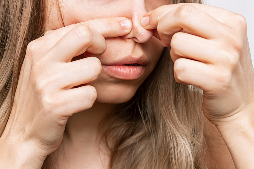 Cropped shot of young woman squeezing out a black heads or comedones with her fingers. Acne problem