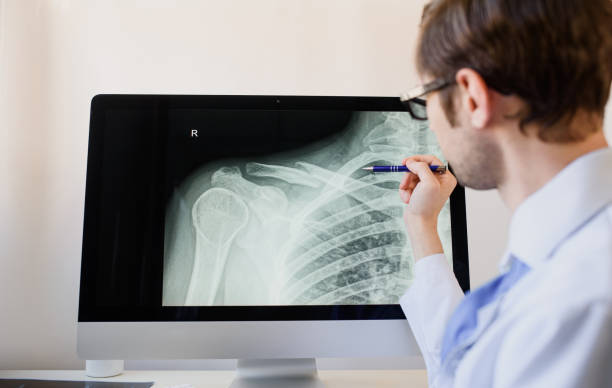 radiologist analyzing a patient x ray with a clavicle fracture. Man radiologist analyzing a patient x ray with a clavicle fracture. clavicle stock pictures, royalty-free photos & images