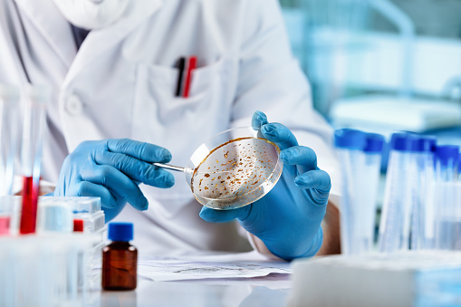 Lab technician researching with petri plate for analysis in the laboratory microscope. Microbiologist working and examining mold and fungal cultures in petri dishes in the microbiology laboratory