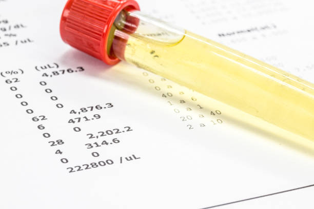 flaconcino di urina in laboratorio, tossicologia o esame di routine - doping test foto e immagini stock