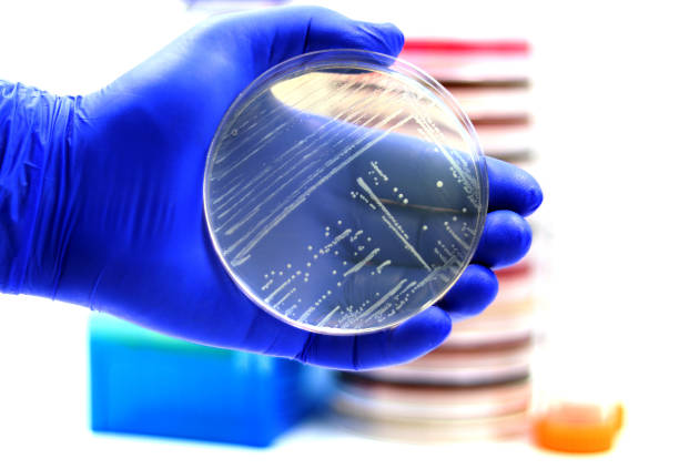 Listeria monocytogenes The human pathogenic bacterium Listeria monocytogenes growing in a plate of Luria agar plasmids stock pictures, royalty-free photos & images
