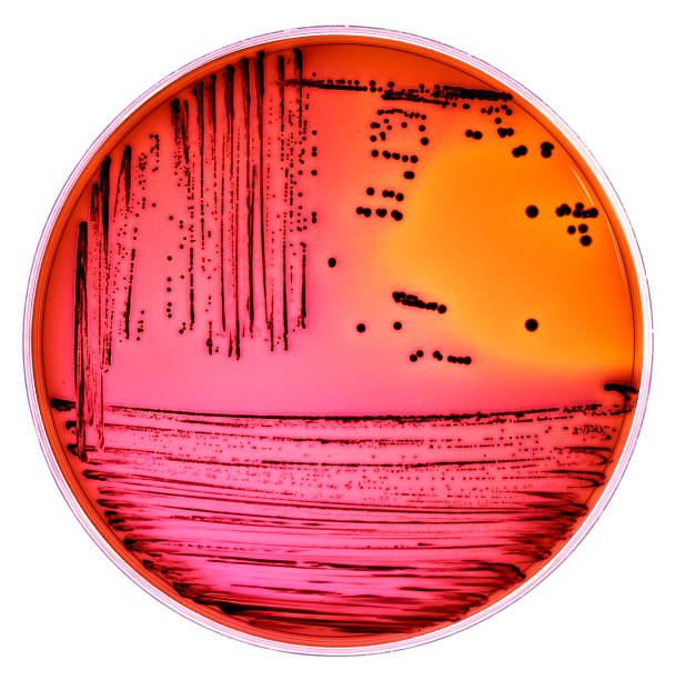 escherichia coli bacteria - petri dish bacterium colony laboratory imagens e fotografias de stock