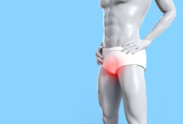 3d render illustration of male figure with prostate problem. stock photo