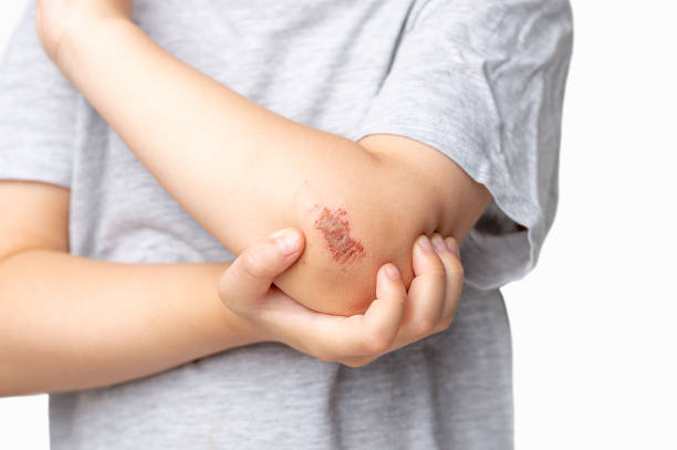 child with a wound in his arm Children injury. Deep scratches on the skin of the children's elbow hand. Wounds, scratches, abrasions on the child's arm on a white background skin scrape stock pictures, royalty-free photos & images