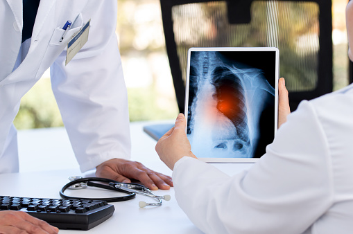 médico explicando los resultados de la gammagrafía pulmonar en tableta digital a su colega photo