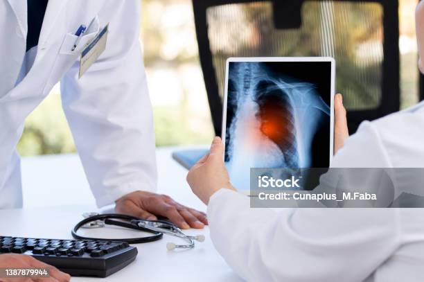 Doctor Explaining Lung Scan Results On Digital Tablet To His Colleague Stock Photo - Download Image Now