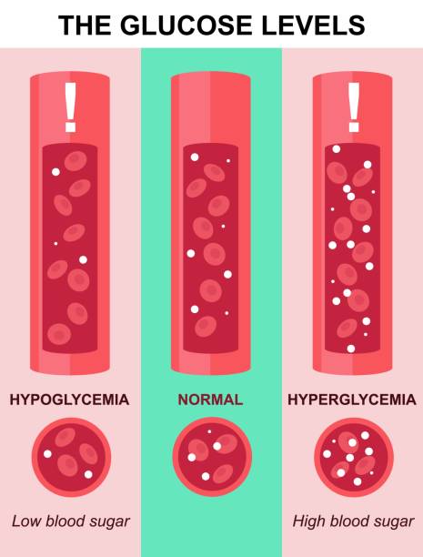 badanie poziomu glukozy w analizie laboratoryjnej wektorów krwi - hyperglycemia stock illustrations